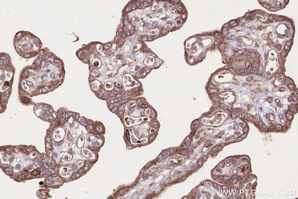 IHC staining of human placenta using 17143-1-AP IHC staining of human placenta using 17143-1-AP