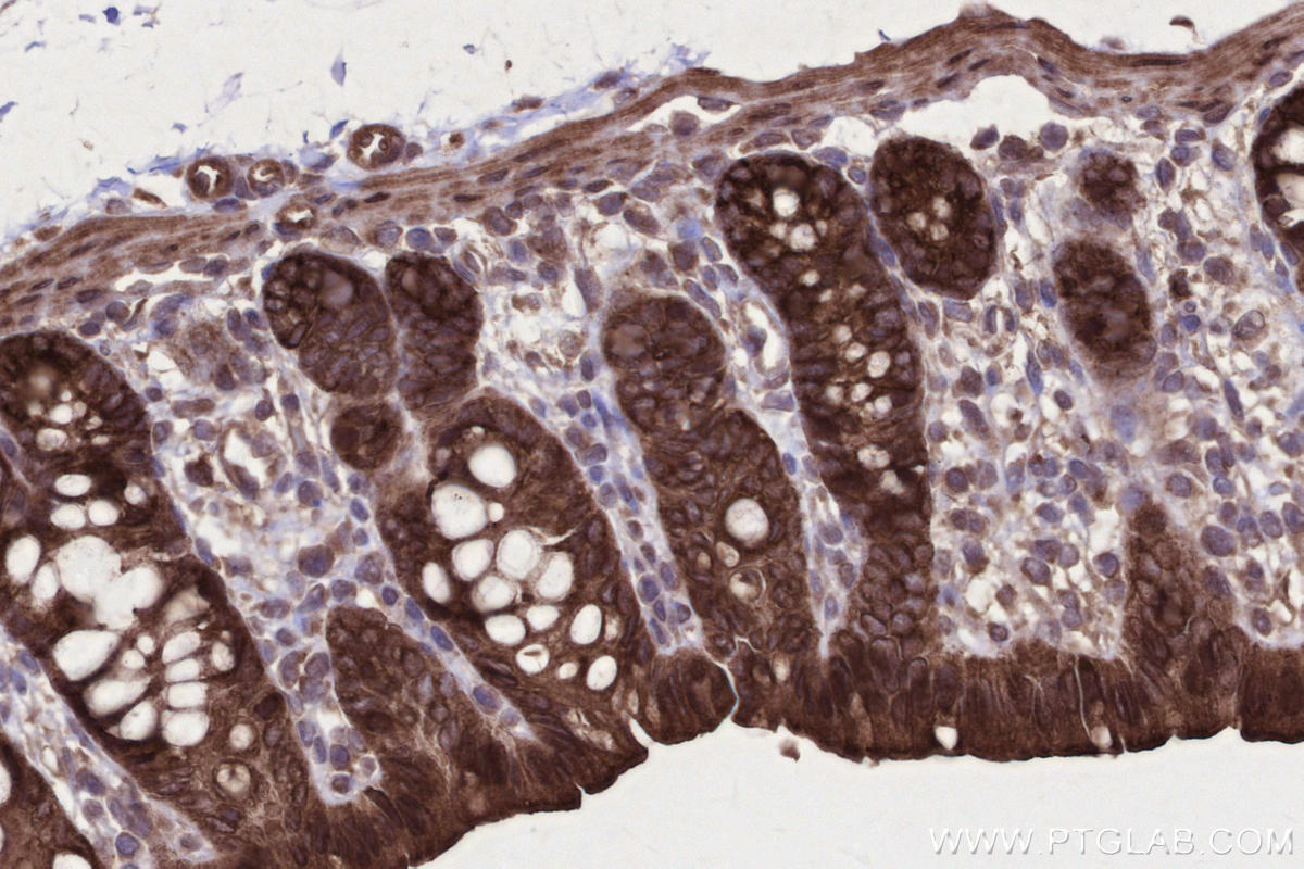 IHC staining of rat colon using 17143-1-AP IHC staining of rat colon using 17143-1-AP