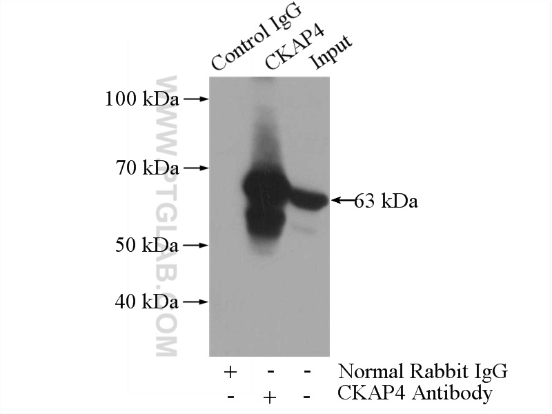 IP experiment of HeLa using 16686-1-AP