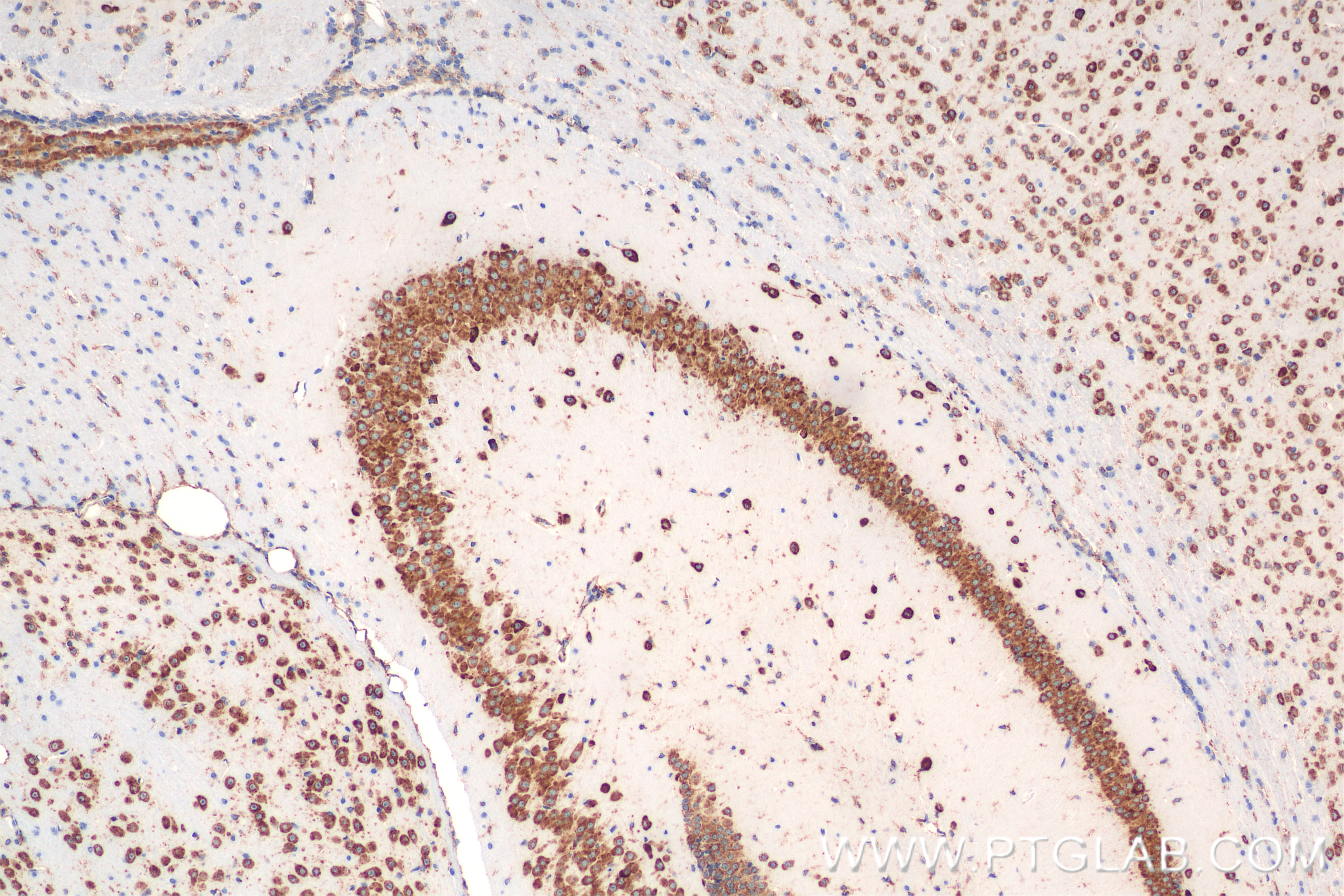 IHC staining of mouse brain using 84485-5-RR (same clone as 84485-5-PBS)