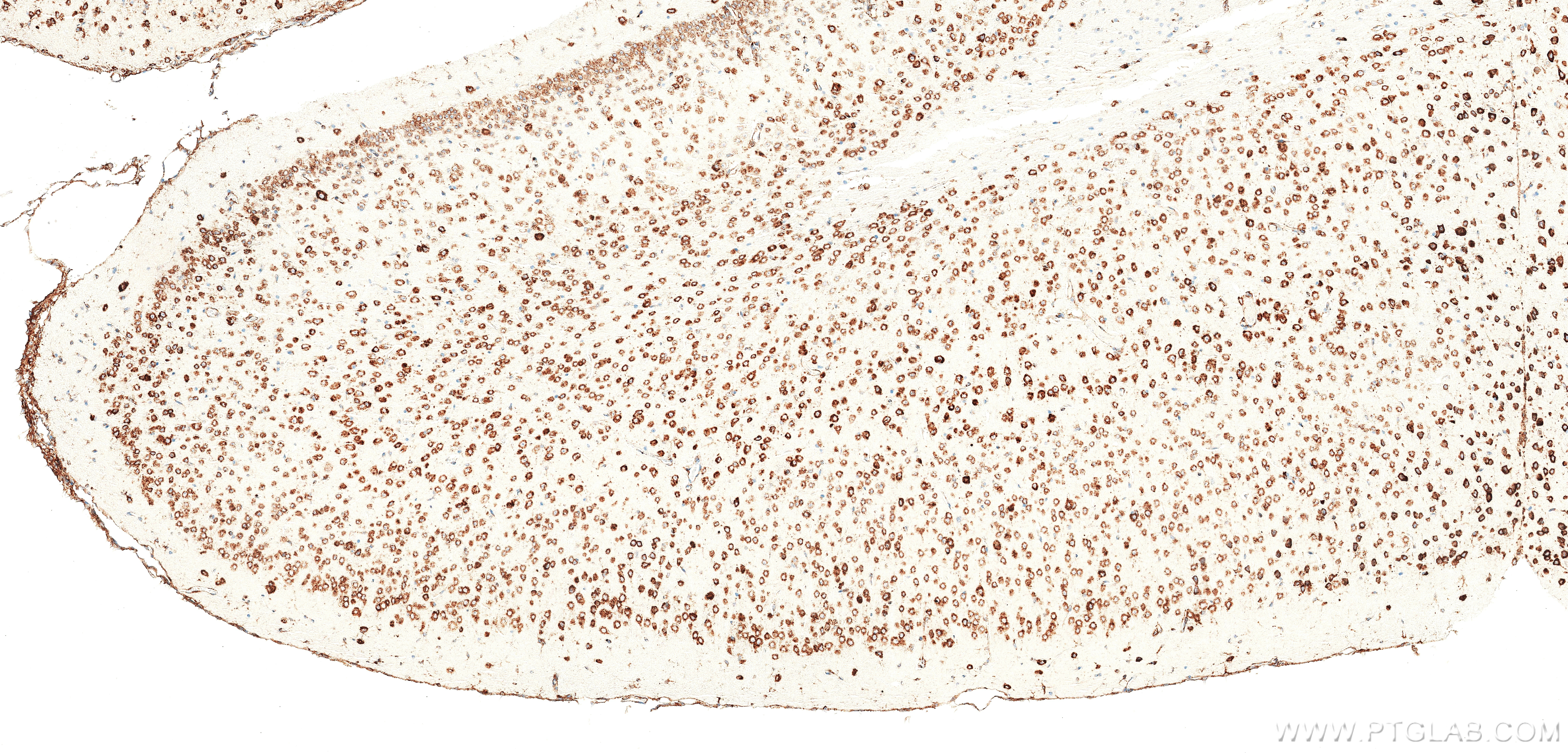 IHC staining of mouse brain using 84485-5-RR