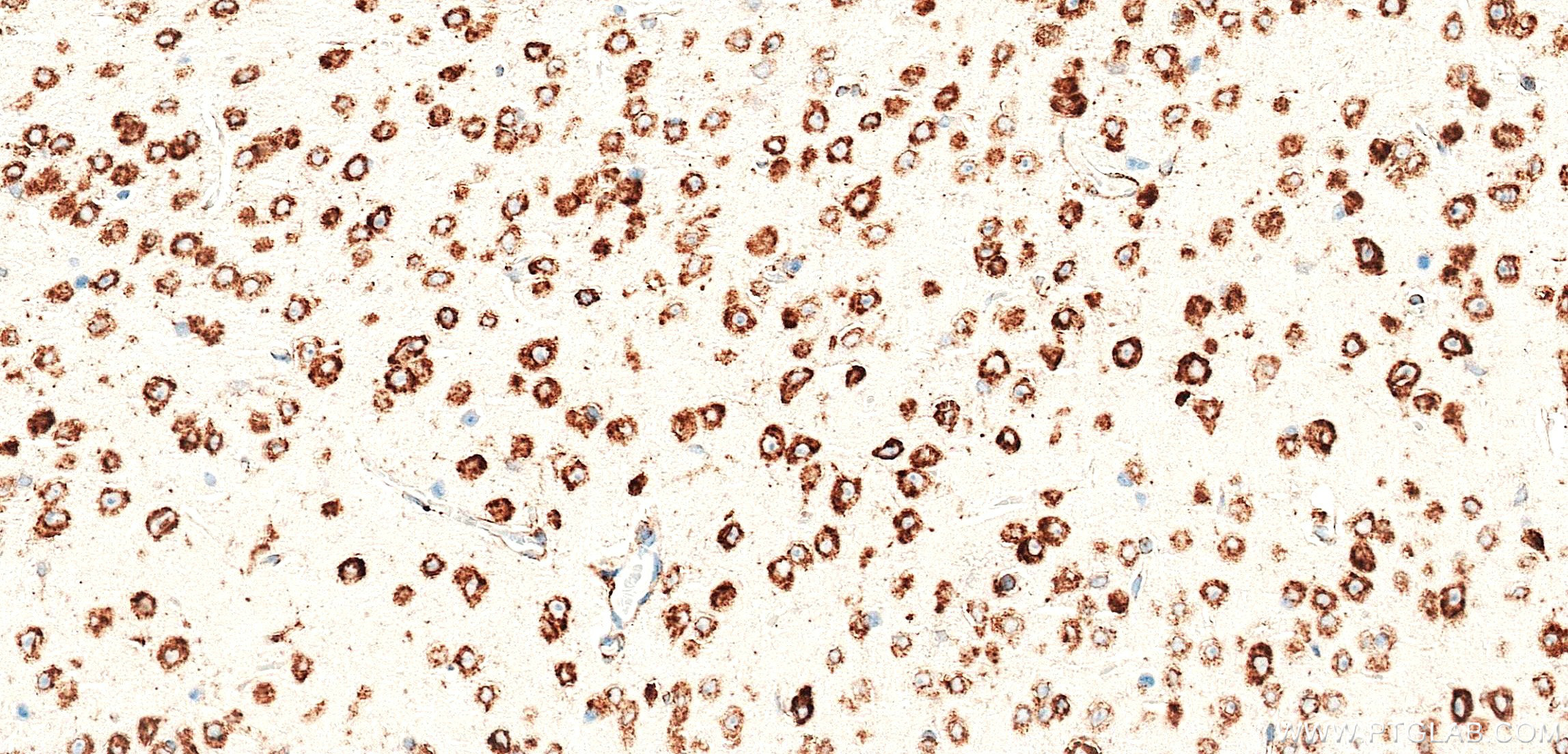 IHC staining of mouse brain using 84485-5-RR