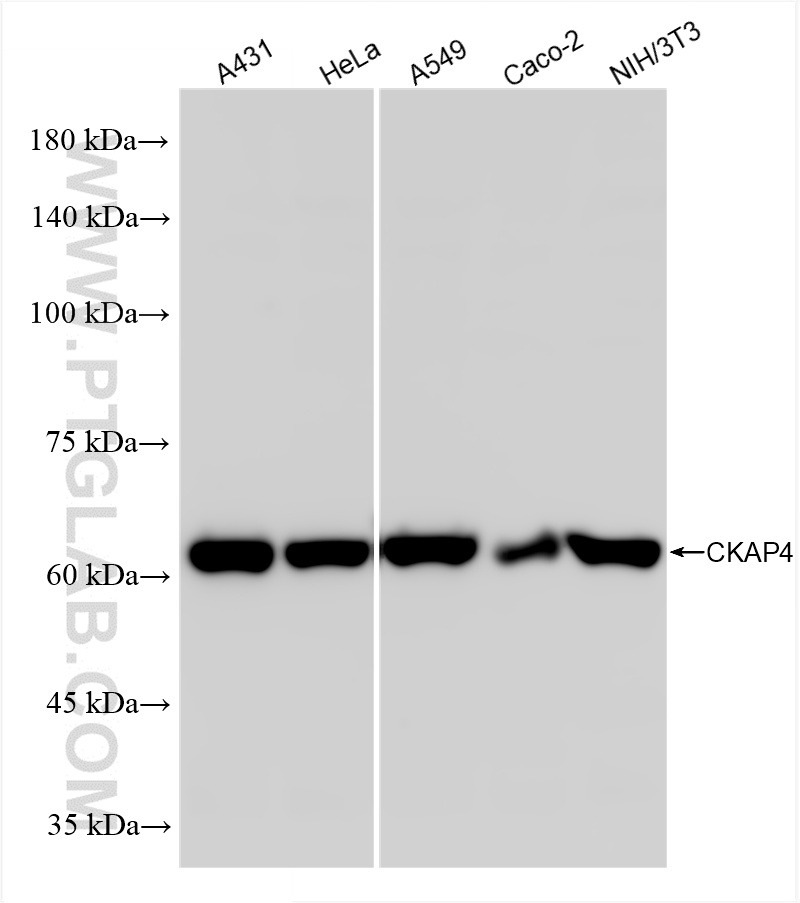 WB analysis using 84485-5-RR (same clone as 84485-5-PBS)