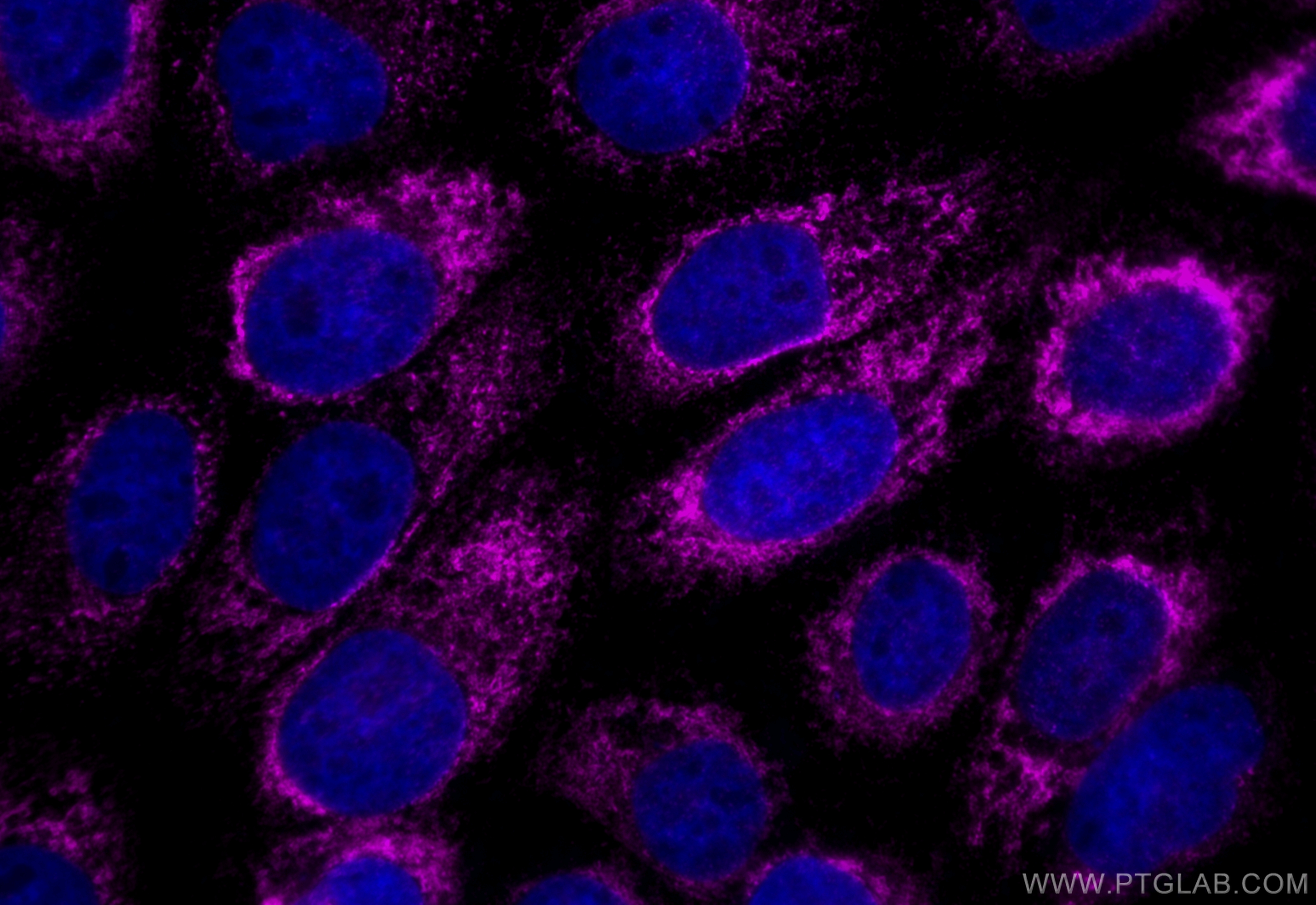 IF Staining of A431 using CL647-84485-4