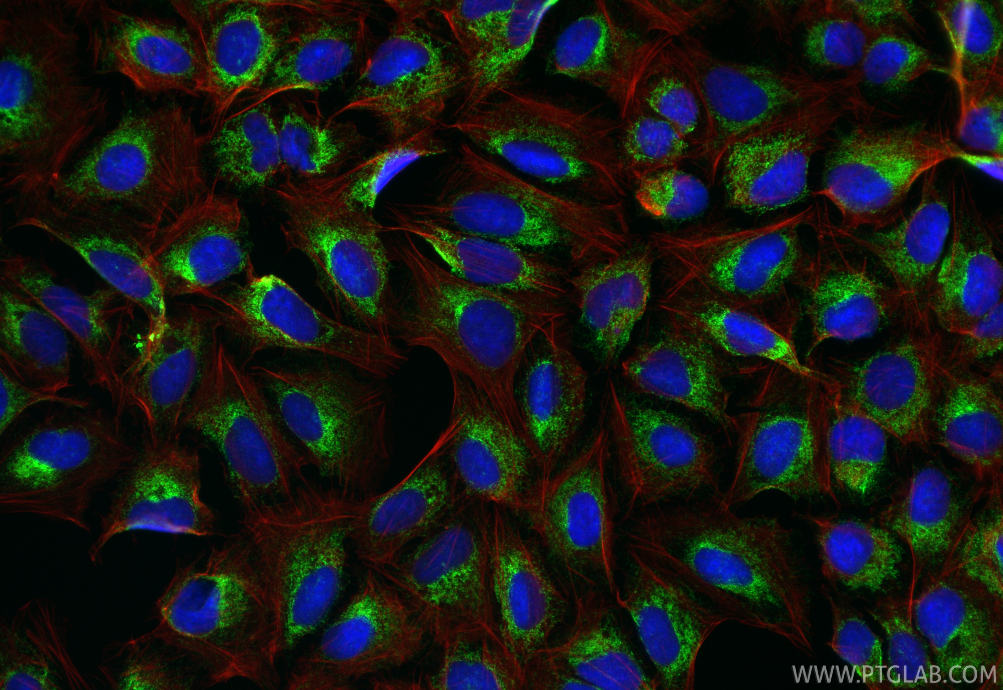 IF Staining of U2OS using RMX00054 IF Staining of U2OS using RMX00054