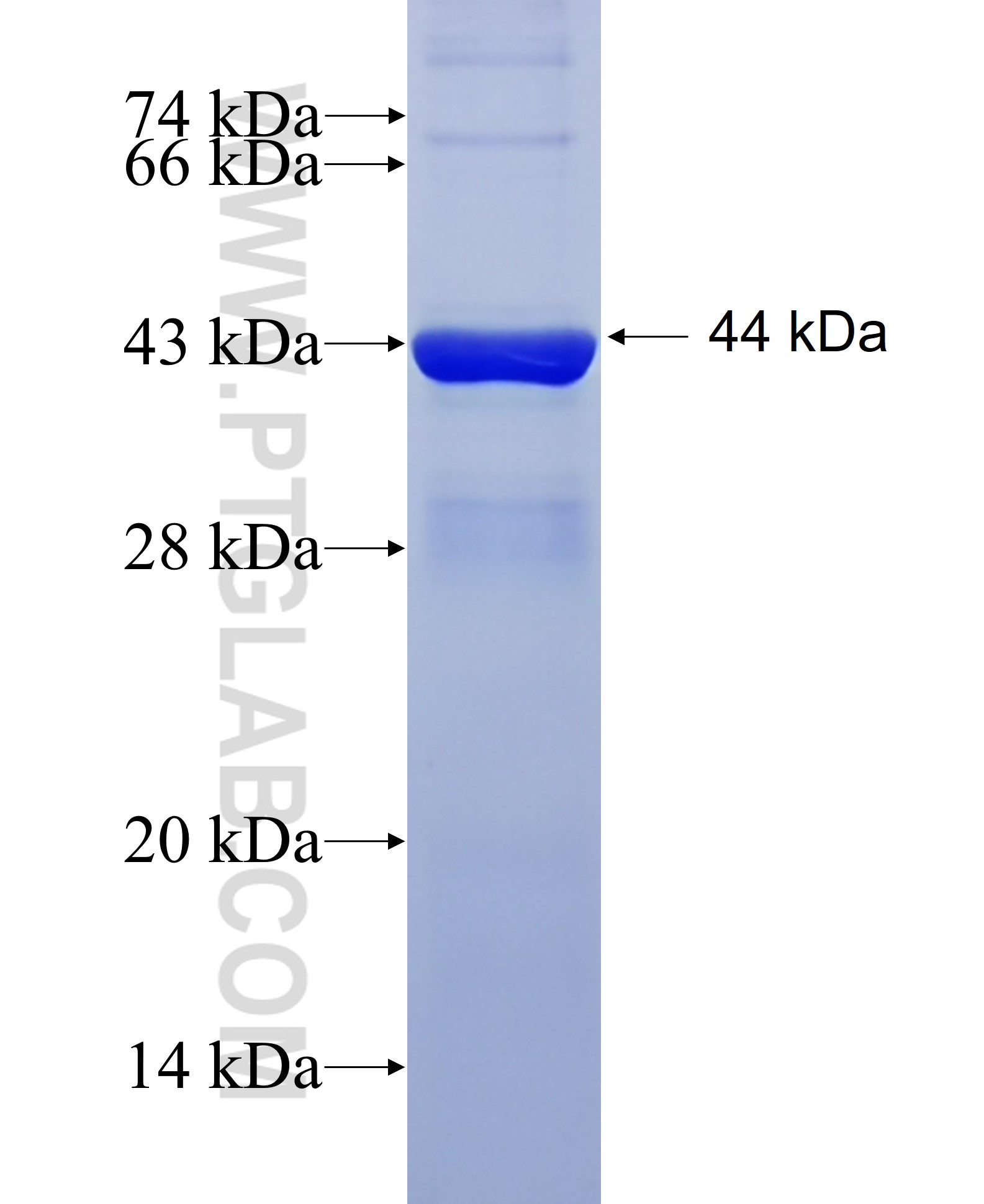 CKAP4 fusion protein Ag10022 SDS-PAGE