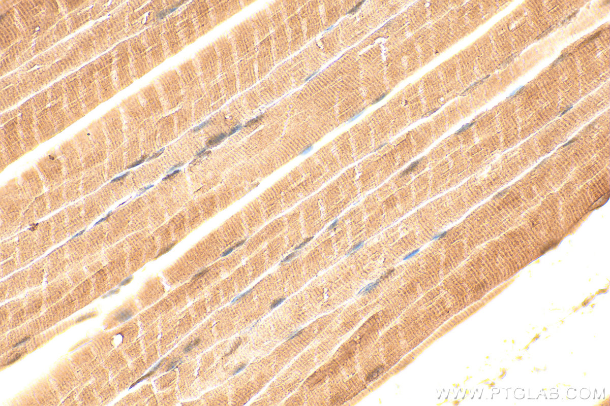 Immunohistochemical analysis of paraffin-embedded mouse skeletal muscle tissue slide using 15137-1-AP (CKB/CKM antibody) at dilution of 1:2000 (under 40x lens). Heat mediated antigen retrieval with Tris-EDTA buffer (pH 9.0). IHC staining of mouse skeletal muscle using 15137-1-AP