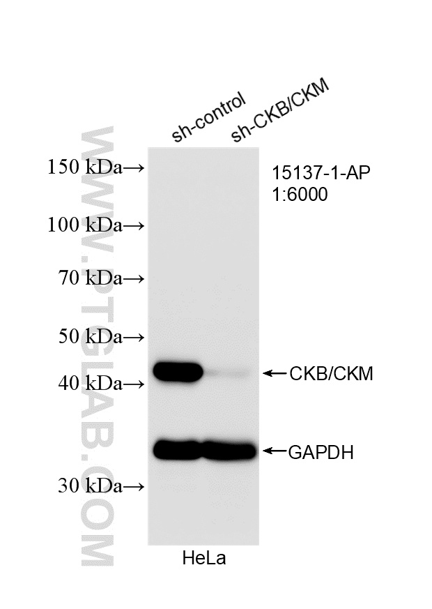 WB analysis of HeLa using 15137-1-AP WB analysis of HeLa using 15137-1-AP