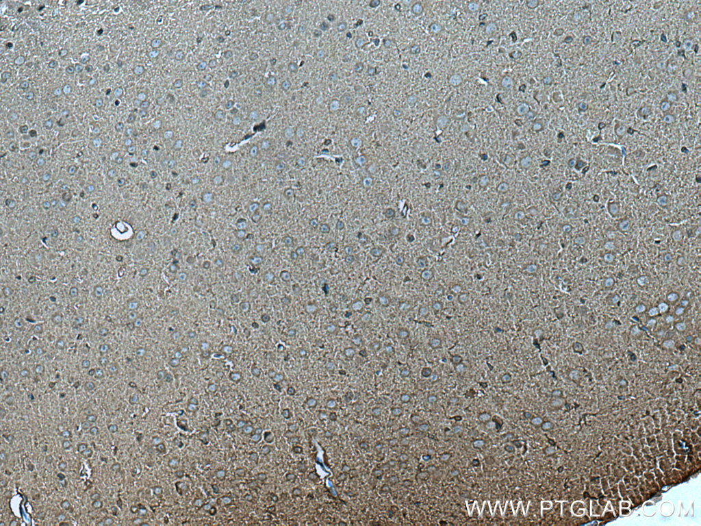 IHC staining of mouse brain using 66764-1-Ig (same clone as 66764-1-PBS)