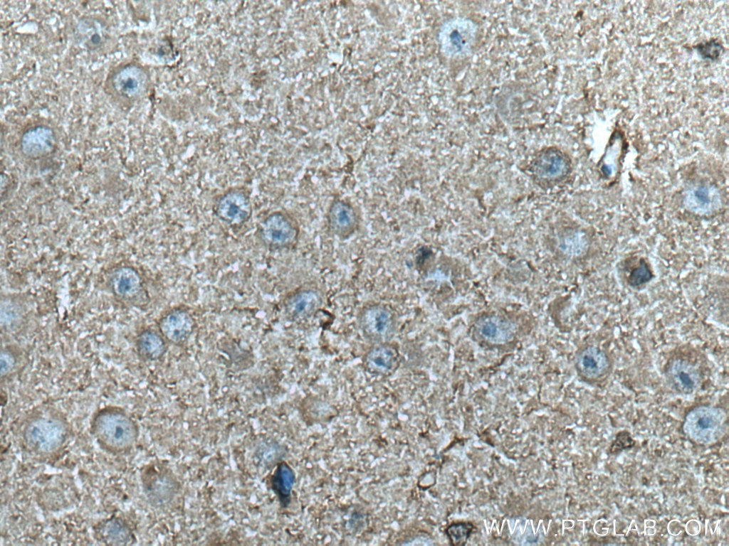 IHC staining of mouse brain using 66764-1-Ig (same clone as 66764-1-PBS)