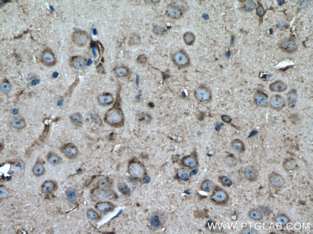 IHC staining of mouse brain using 18713-1-AP