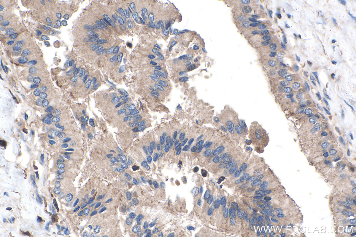 IHC staining of human liver using 60177-1-Ig