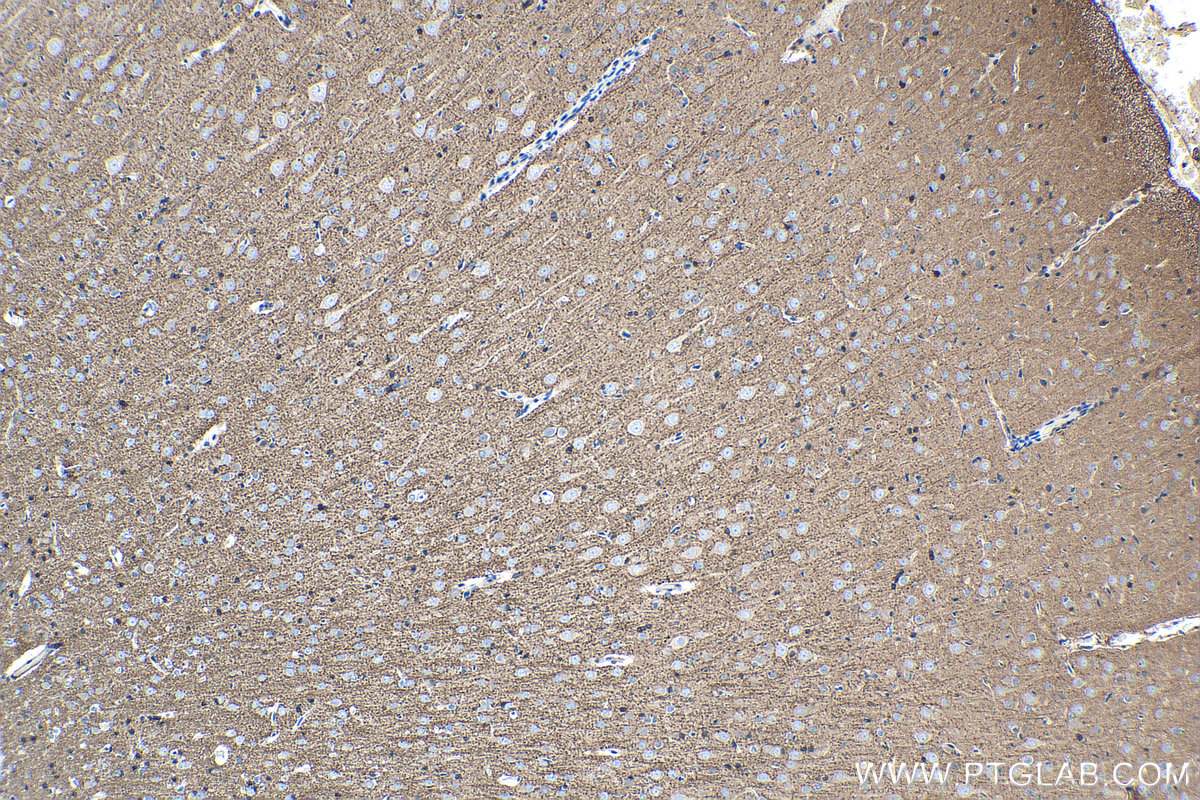 IHC staining of rat brain using 60177-1-Ig