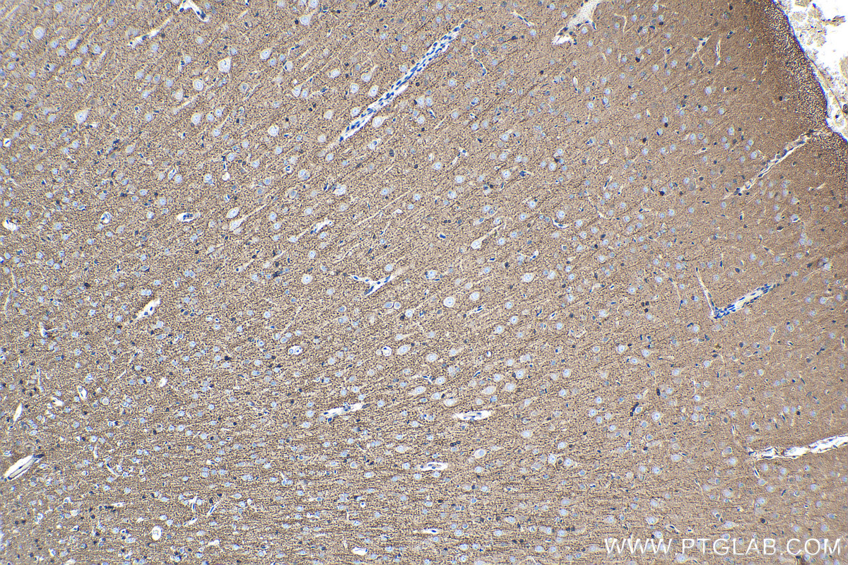 IHC staining of rat brain using 60177-1-Ig