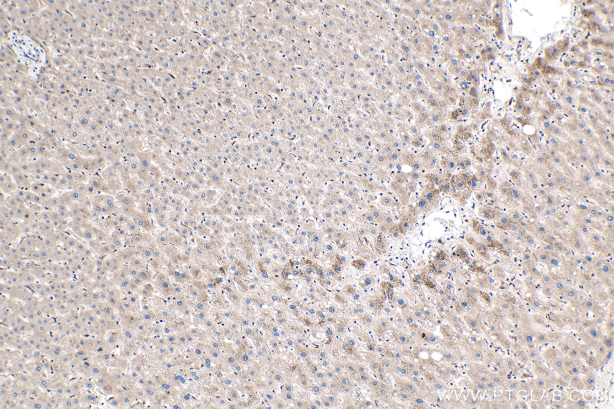 IHC staining of human liver using 60177-1-Ig