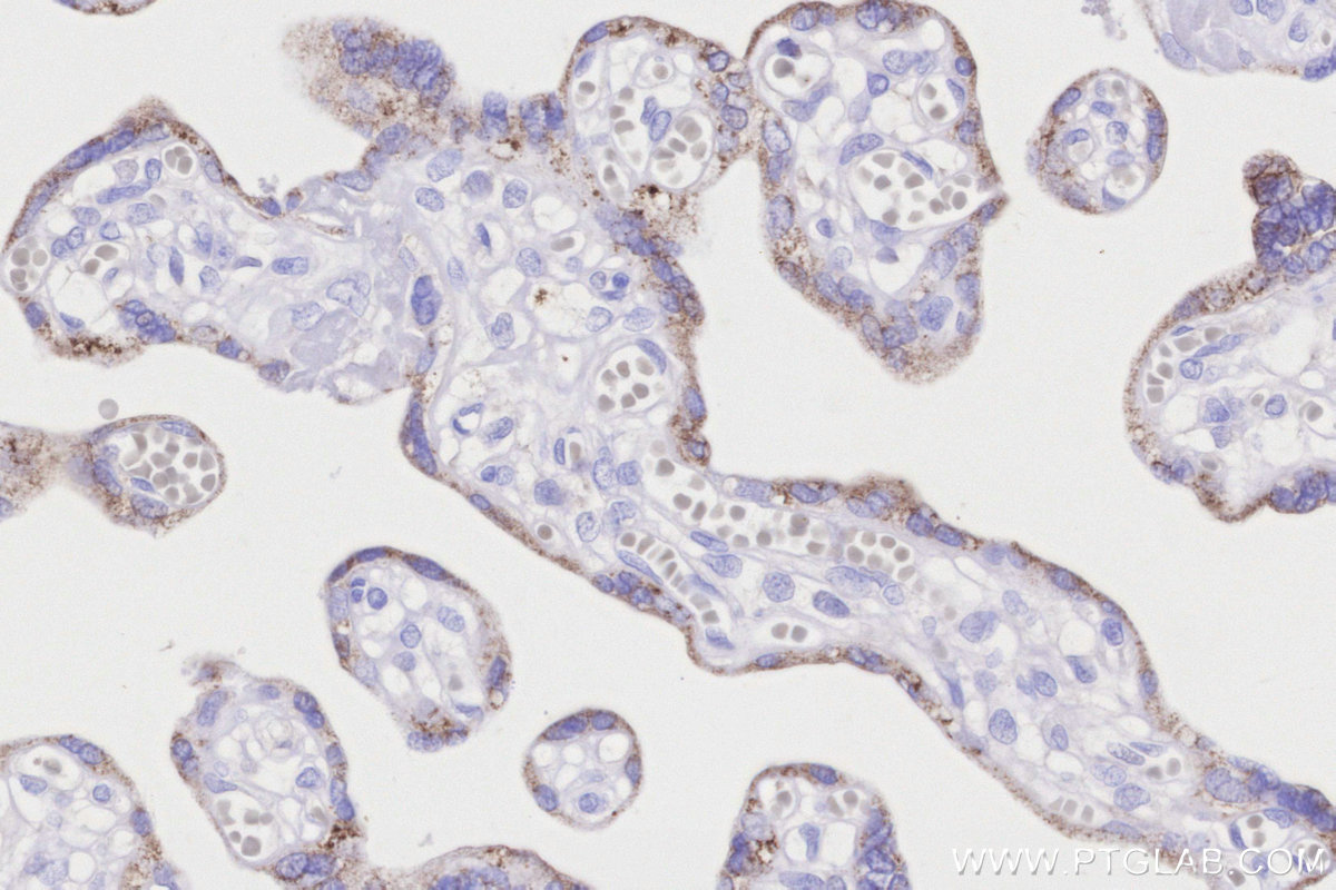 IHC staining of human placenta using 15346-1-AP