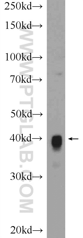 WB analysis of rat heart using 15346-1-AP