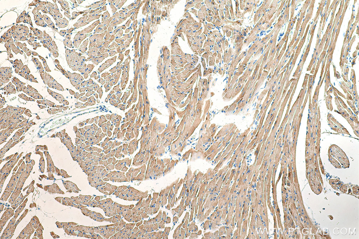 IHC staining of mouse heart using 13207-1-AP