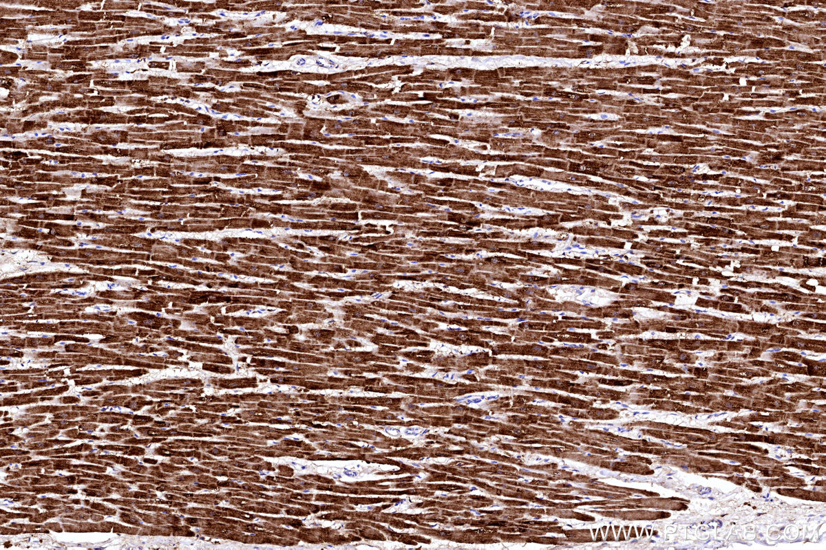 IHC staining of human heart using 13207-1-AP IHC staining of human heart using 13207-1-AP