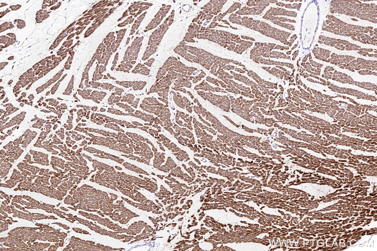 IHC staining of rat heart using 13207-1-AP IHC staining of rat heart using 13207-1-AP