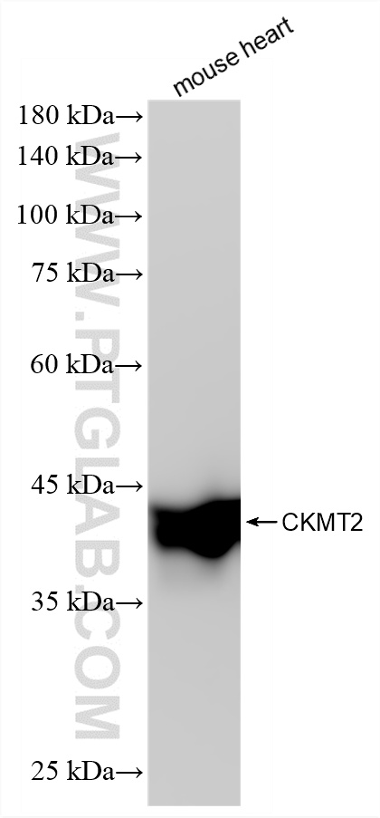 WB analysis of mouse heart using 87517-1-RR