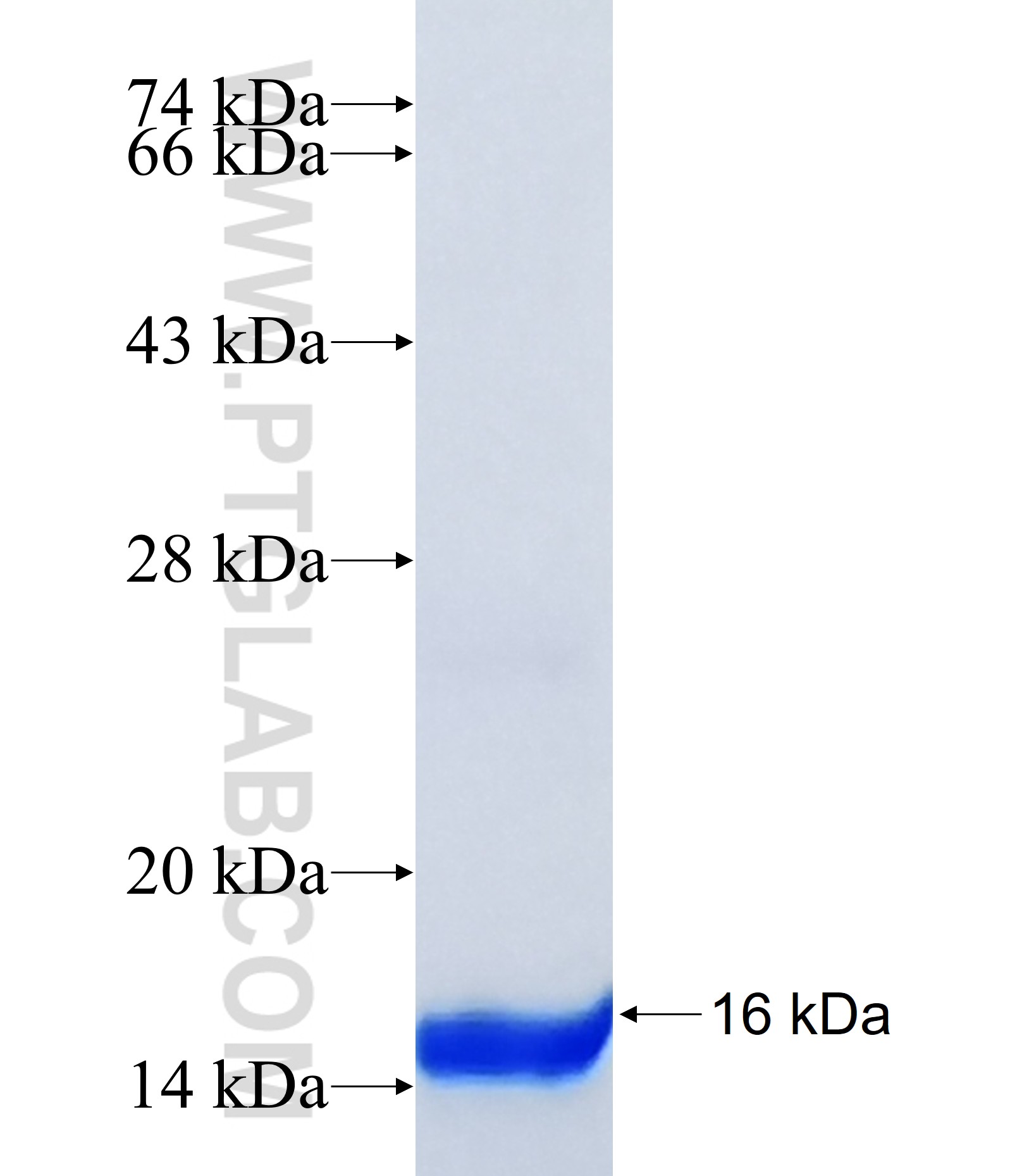 CKS1B fusion protein Ag34569 SDS-PAGE CKS1B fusion protein Ag34569 SDS-PAGE
