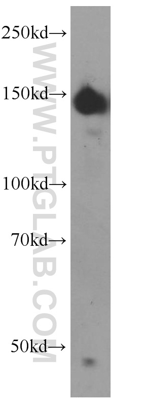 CLASP2 Polyclonal antibody