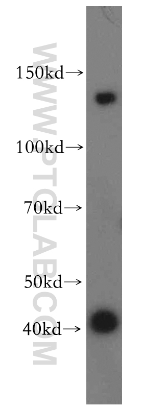 WB analysis of mouse lung using 19273-1-AP