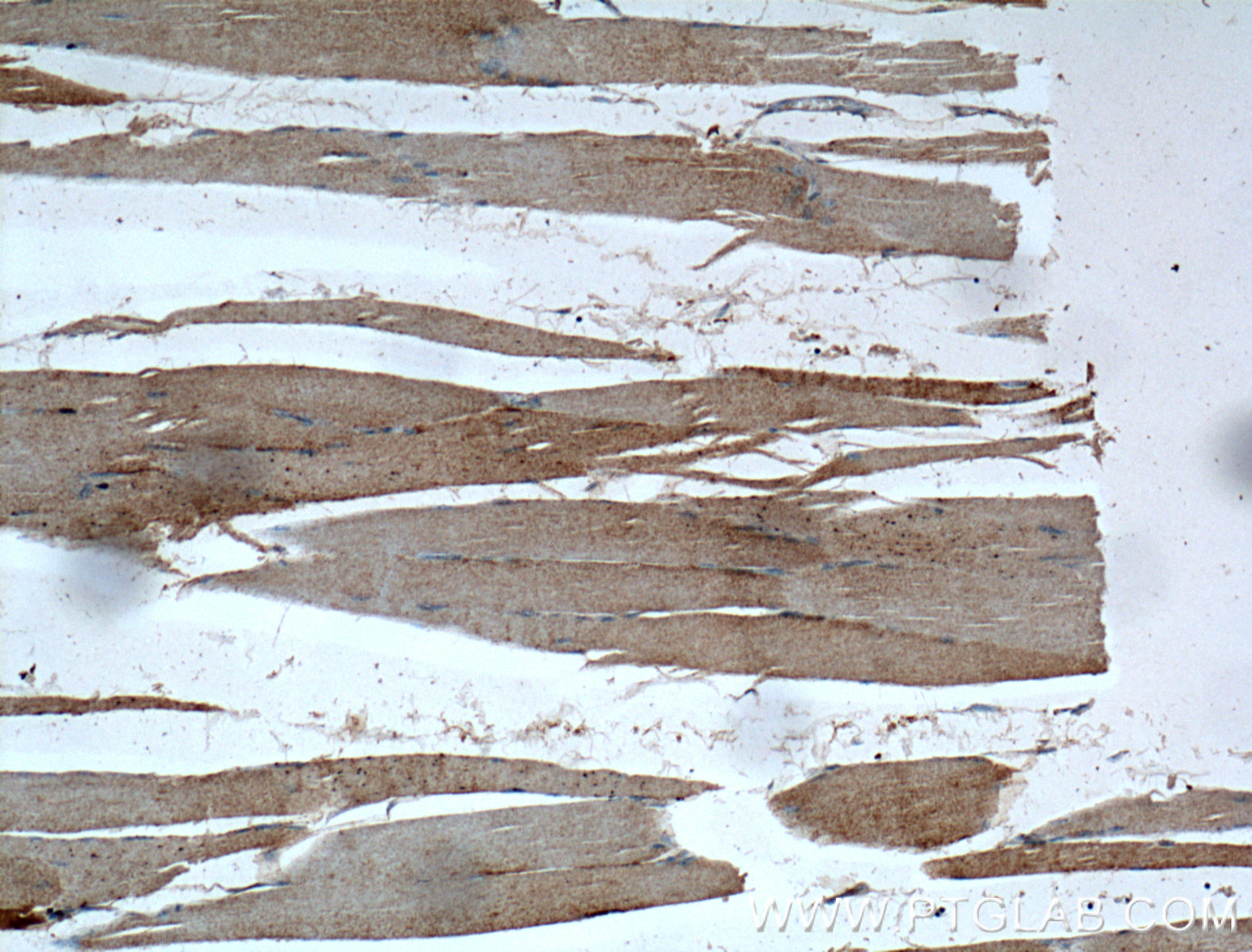 IHC staining of human skeletal muscle using 18595-1-AP