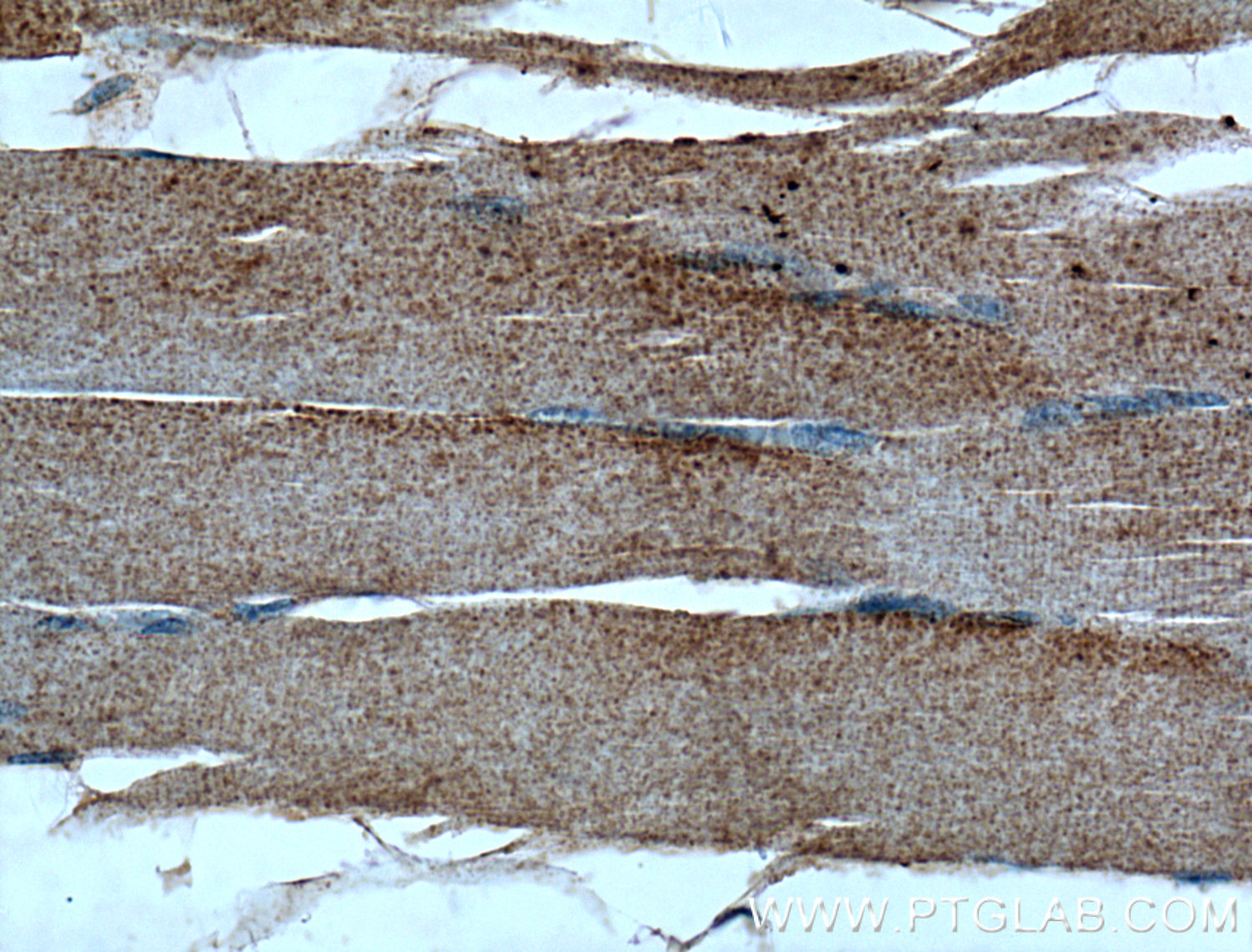 IHC staining of human skeletal muscle using 18595-1-AP