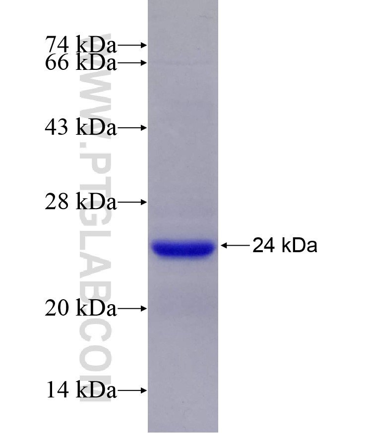 CLCN2 fusion protein Ag29066 SDS-PAGE