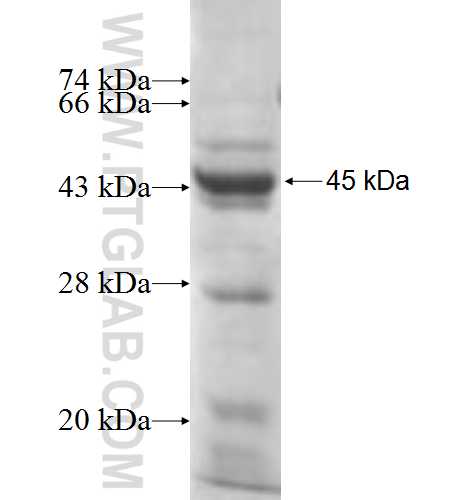 CLCN2 fusion protein Ag8293 SDS-PAGE CLCN2 fusion protein Ag8293 SDS-PAGE