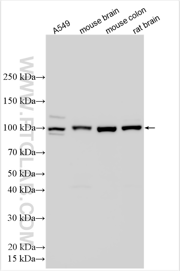 WB analysis using 55330-1-AP