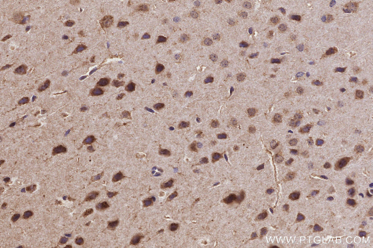 IHC staining of mouse brain using 29230-1-AP (same clone as 29230-1-PBS)
