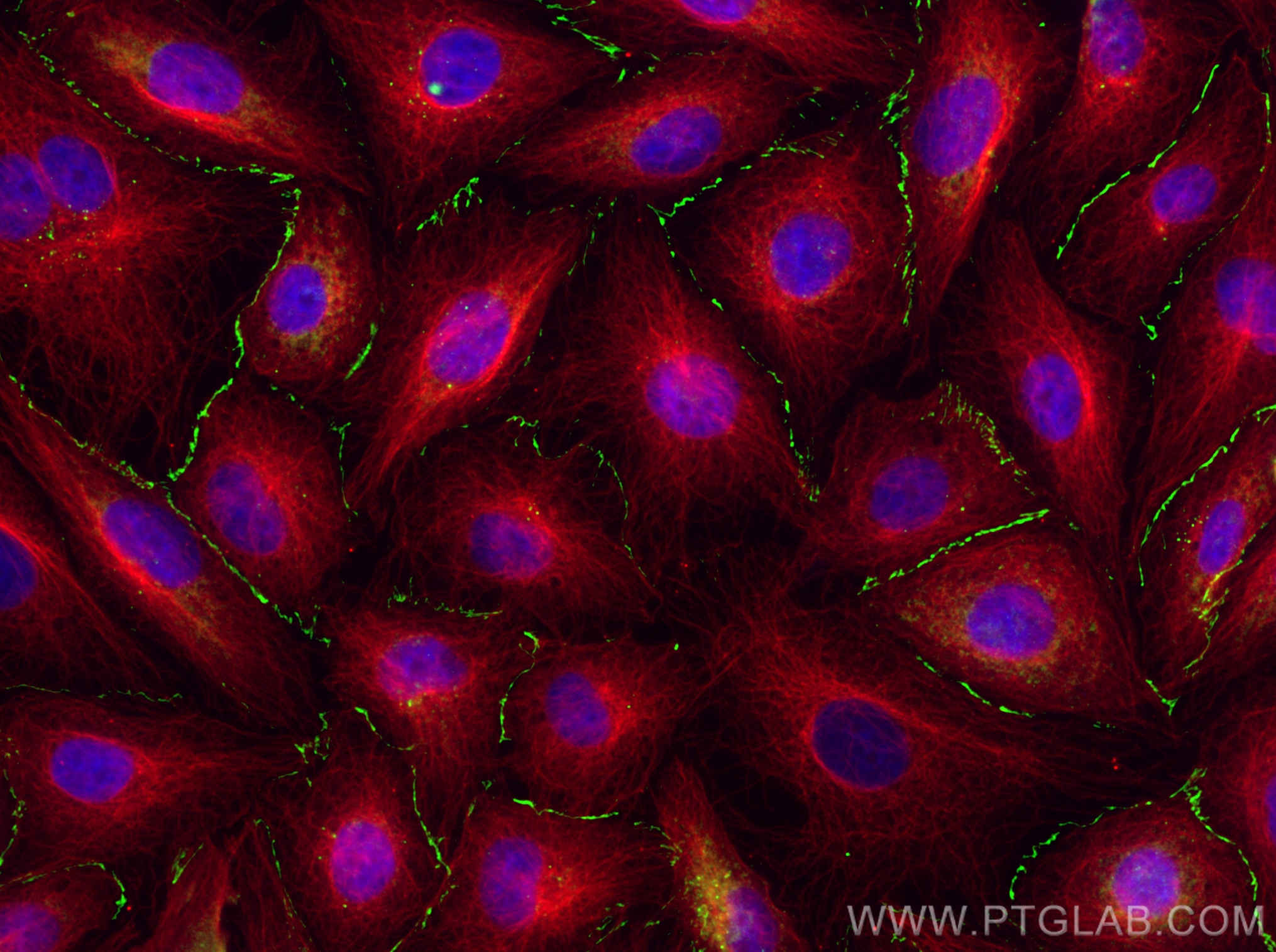 IF Staining of HUVEC using 13050-1-AP