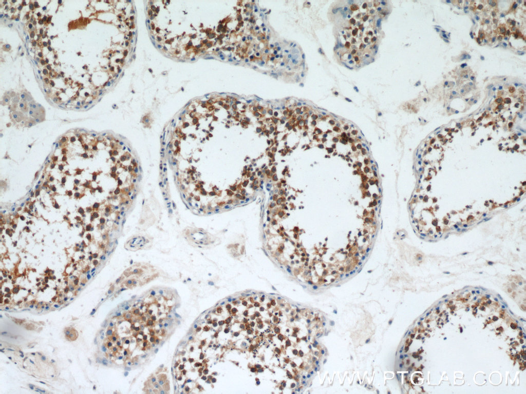 IHC staining of human testis using 12152-1-AP