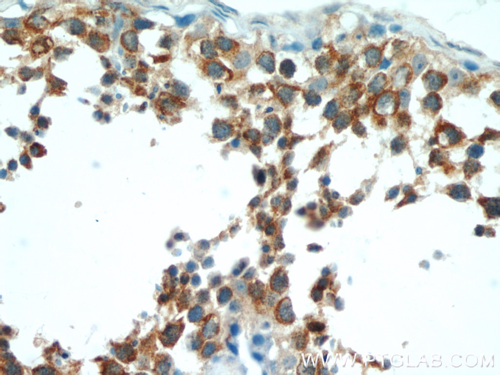 IHC staining of human testis using 12152-1-AP