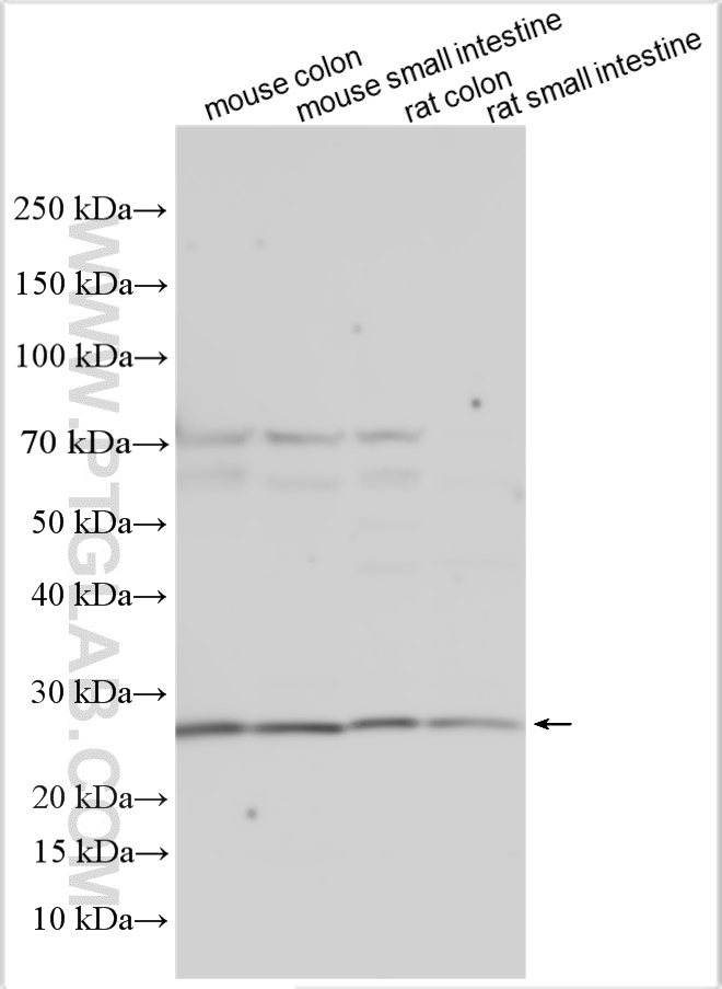 WB analysis using 16302-1-AP