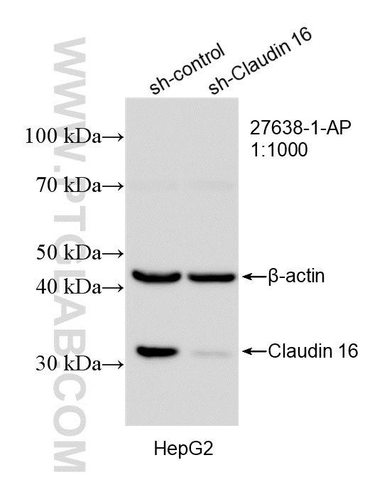 WB analysis of HepG2 using 27638-1-AP