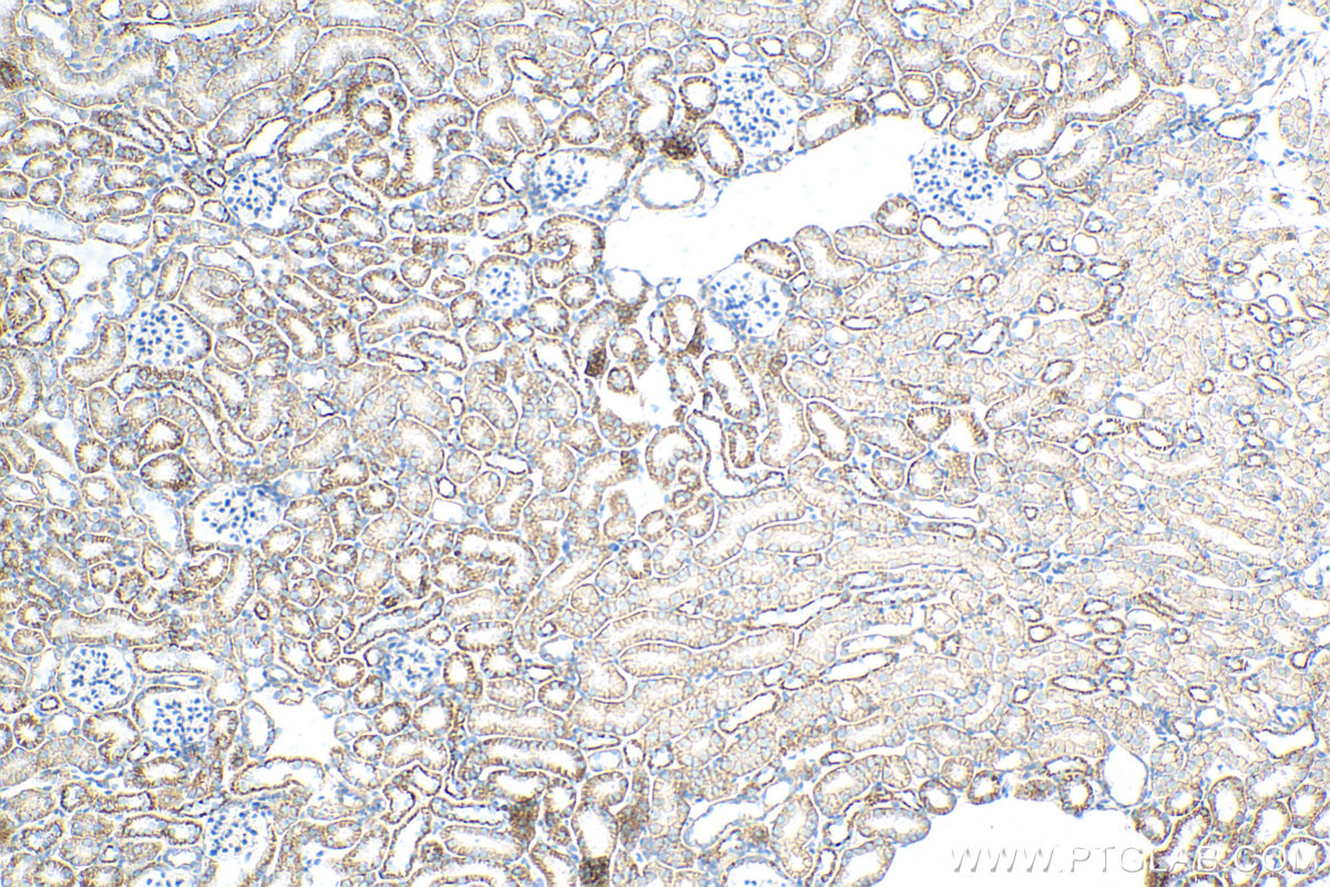 IHC staining of mouse kidney using 82954-1-RR
