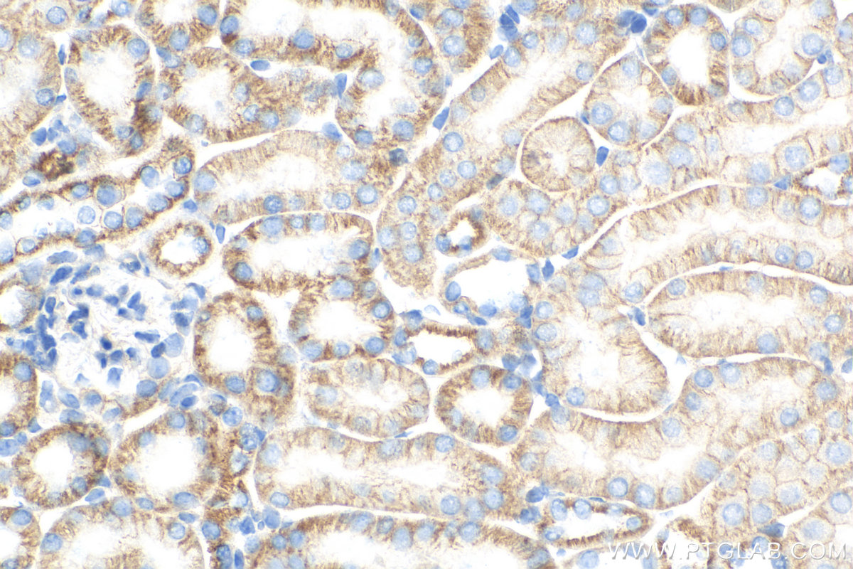 IHC staining of mouse kidney using 82954-1-RR