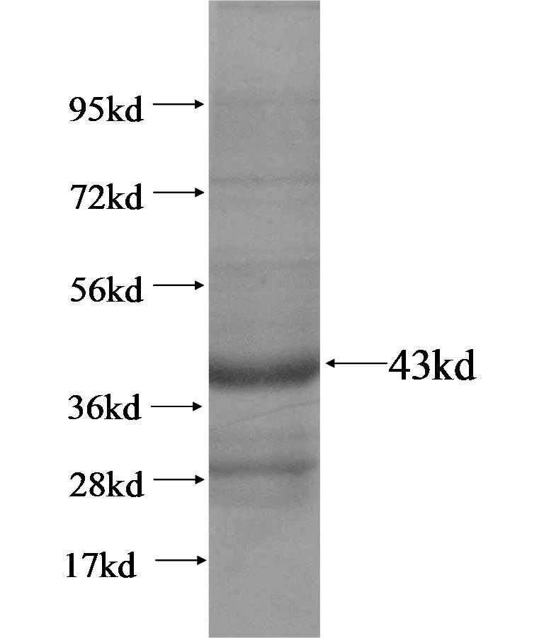 CLDN16 fusion protein Ag14929 SDS-PAGE CLDN16 fusion protein Ag14929 SDS-PAGE