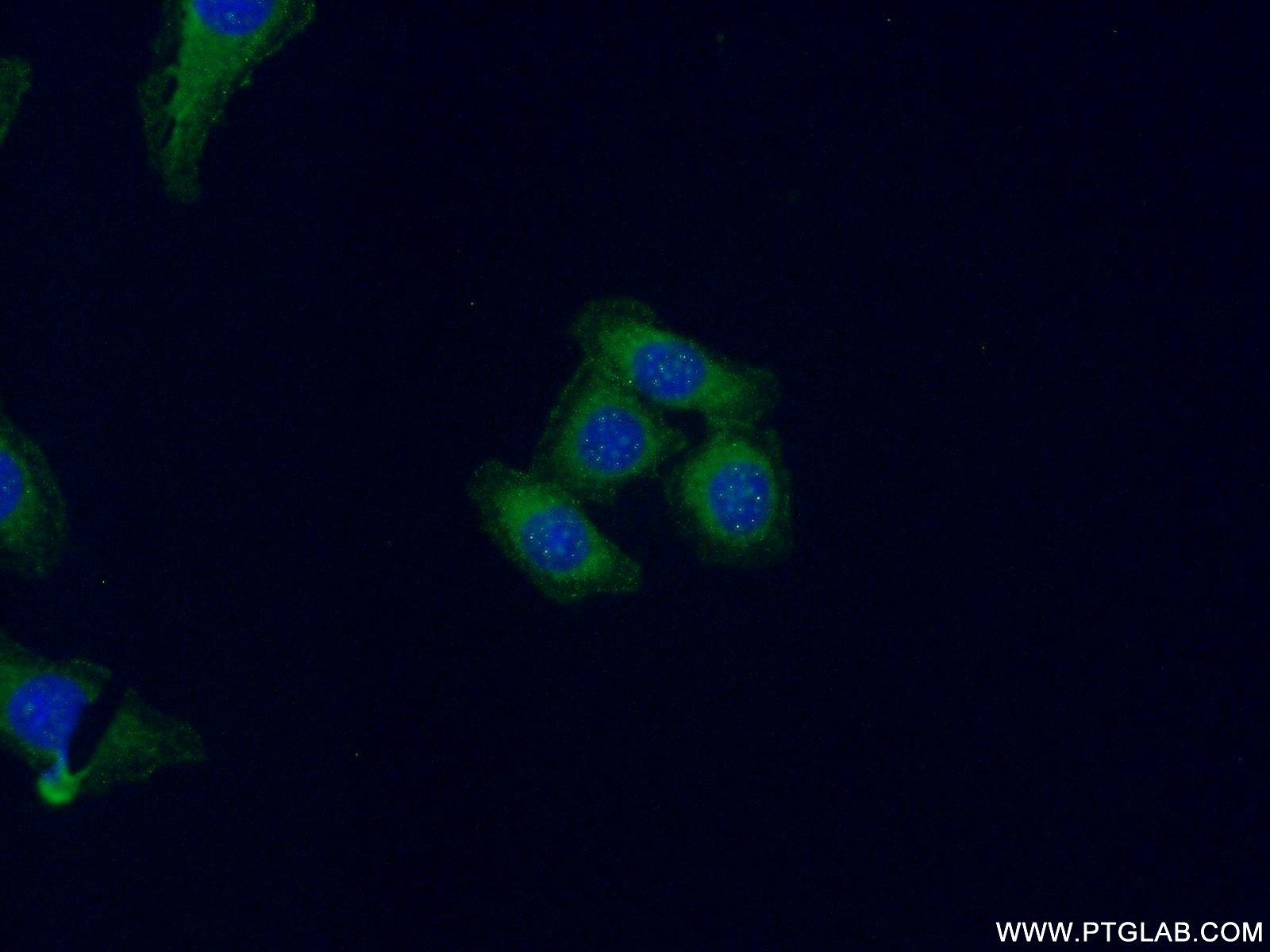 IF Staining of MKN-45 using 21126-1-AP