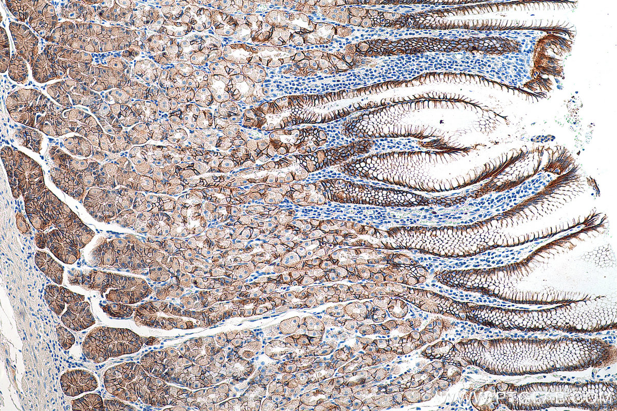IHC staining of human stomach using 21126-1-AP