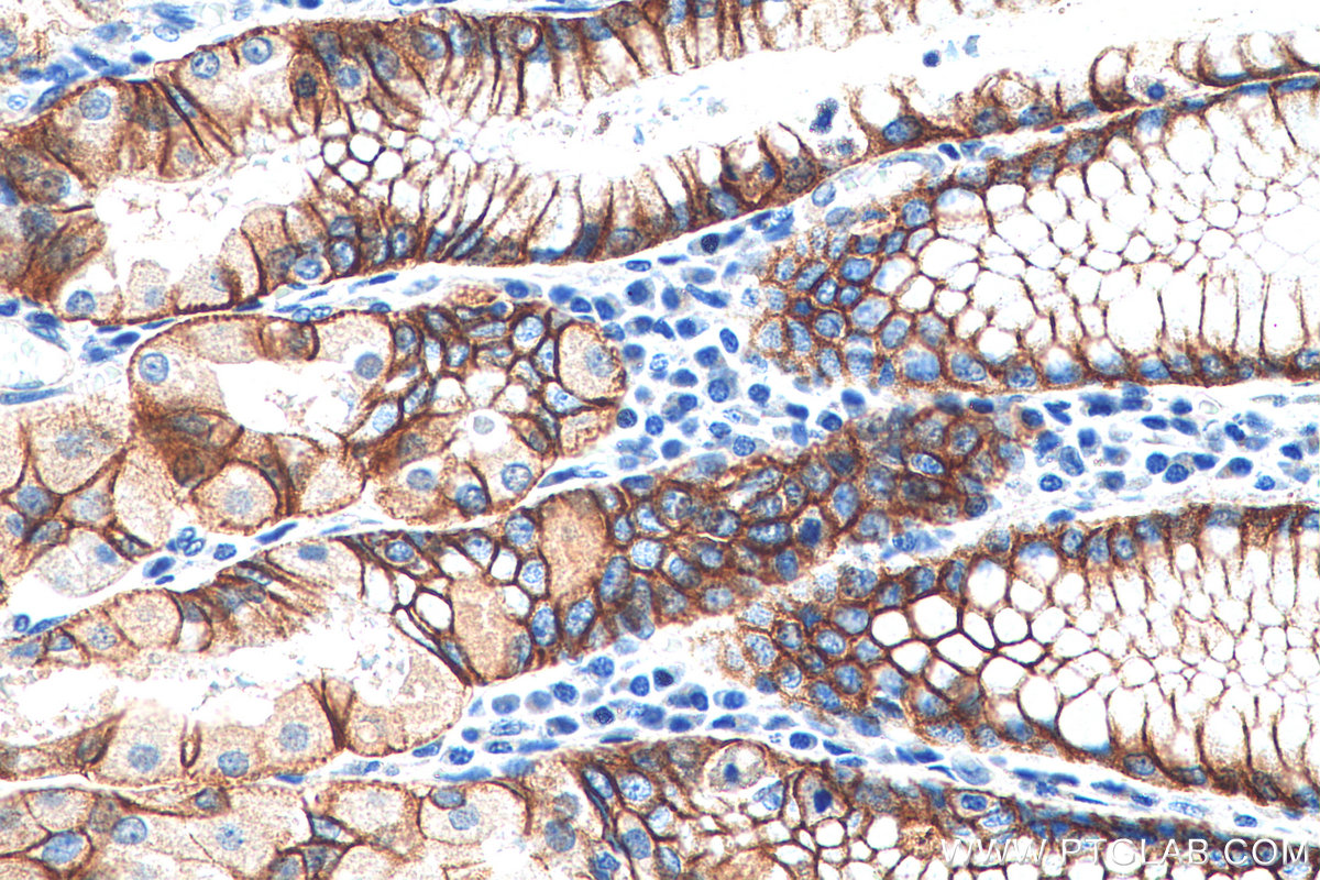 IHC staining of human stomach using 21126-1-AP
