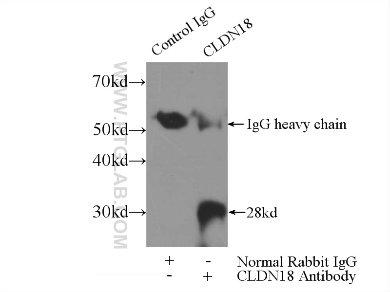 IP experiment of mouse stomach using 21126-1-AP