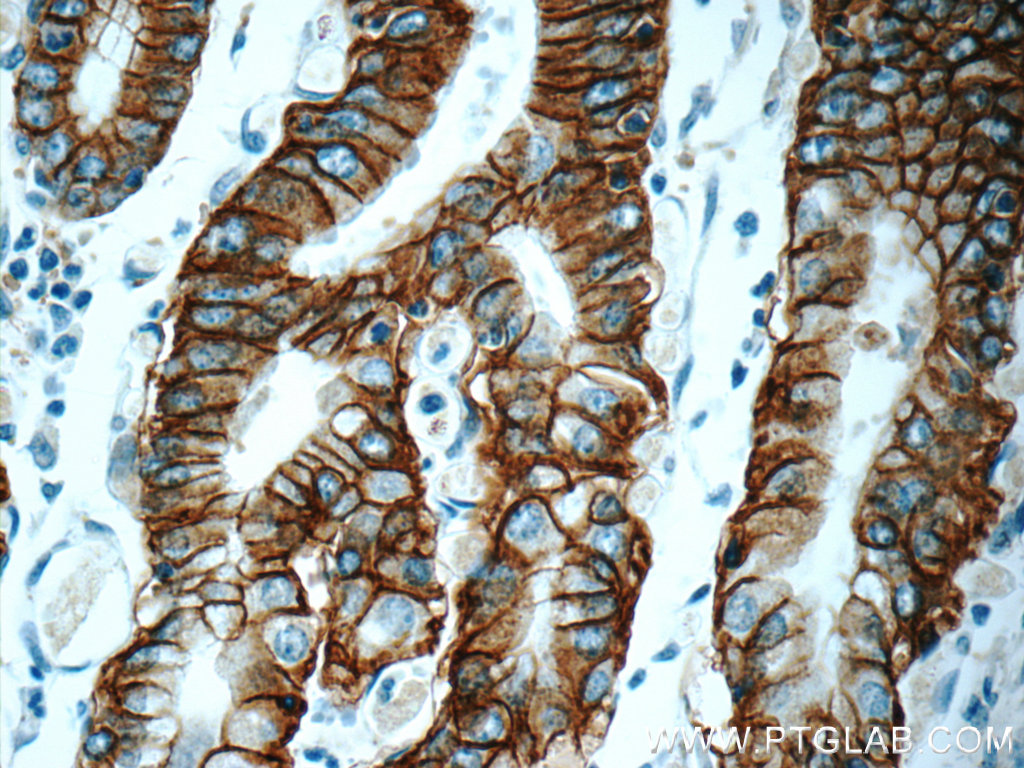 Claudin 18 Monoclonal antibody