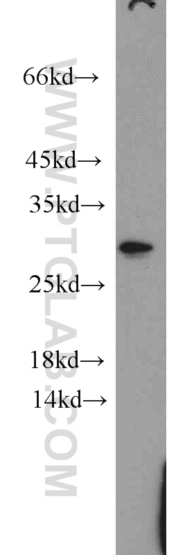 WB analysis of HeLa using 20724-1-AP
