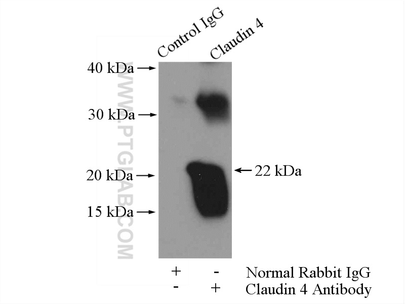 IP experiment of human placenta using 16195-1-AP