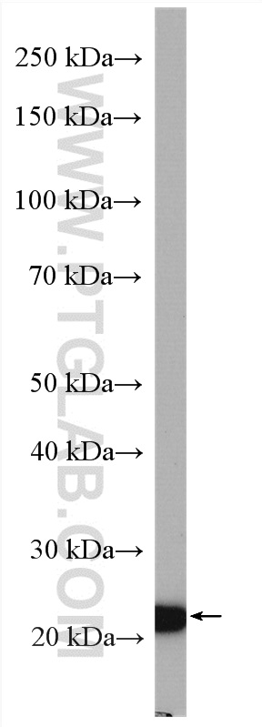 WB analysis of MDA-MB-453s using 16195-1-AP